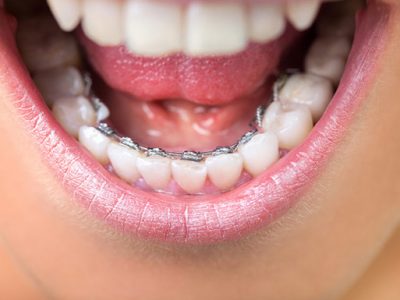 curso introducción a la ortodoncia